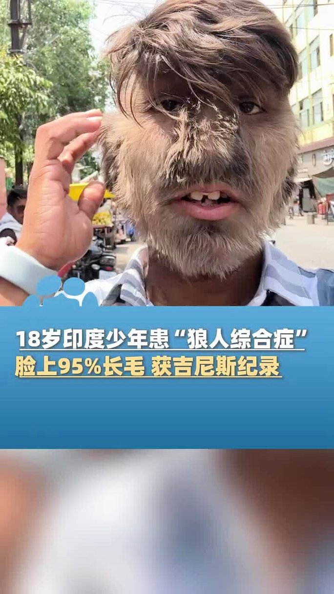 18岁禁止在线看的相关介绍